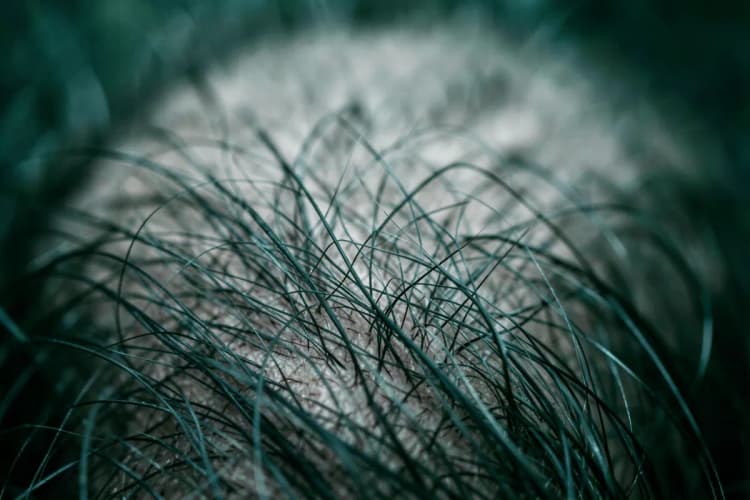 Raízes de cabelo fracas e finas vistas de perto.